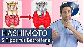 Probleme mit Hashimoto amp der Schilddrüse Dinge auf die Sie unbedingt achten sollten Meine 5 Tipps [upl. by Sirob]