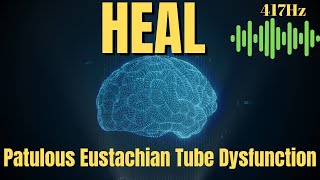 Patulous Eustachian Tube Healing Frequency  Just 30 Mins Per Day [upl. by Nillek]