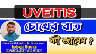 Uveitis কি চোখের বাত কি Treatment of Uveitis  Iritis  CHOROIDITIS  Panuveitis [upl. by Onaicul]