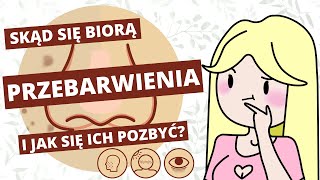 Rozjaśnianie przebarwień i blizn po trądziku  porady i kosmetyki [upl. by Daryl]