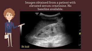 Increased renal cortical echogenicity on ultrasound is not always chronic kidney disease I POCUS [upl. by Algar450]