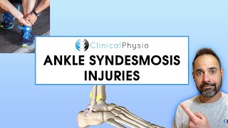 Ankle Syndesmosis Injuries  Expert Physio Overview [upl. by Asilej]