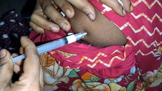 Arm IM Soma Ject Injection Push √√ Injection Videoজন্মবিরতিকরণ ইনজেকশন Ep 45 Injection Vision [upl. by Resa]