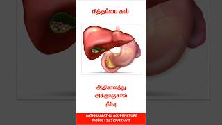 health no12😩Acupressure points for Gallbladder stoneAHH🤯 MustTry gallbladderstone shortsviral [upl. by Rahr]