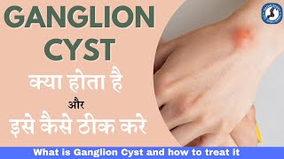 Ganglion Cyst क्या होता है और इसे कैसे ठीक करे  What is Ganglion Cysts Causes amp Treatment [upl. by Summers426]