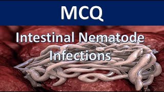 MCQ  Intestinal Nematode Infections with answers [upl. by Ximena]