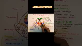 webersyndrome clinicalneuroanatomy midbrain [upl. by Nomaj234]