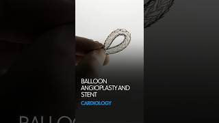 How is Balloon Angioplasty amp Stent Procedure Performed  Demonstration Inside Arteries [upl. by Strage]