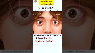 Symptoms of hyperthyroidism  hyperthyroidism ke lakshan  shorts shortfeeds [upl. by Wheeler]