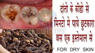 How To Get Rid Of Tooth Cavity Using This Easy Remedy  100 Effective [upl. by God432]