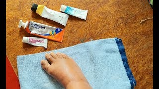 Heilende Salben bei Entzündungen Retterspitz Voltaren Schmerzgel Forte Traumaplant Bebanthen [upl. by Ardeahp]