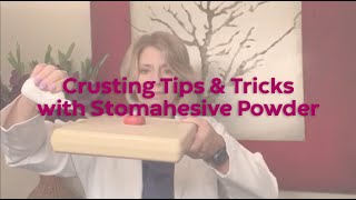 Crusting Tips and Tricks with Stomahesive Powder [upl. by Joete]