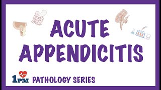 Acute Appendicitis  Definition Diagnosis Lab Findings Treatment [upl. by Louanna]