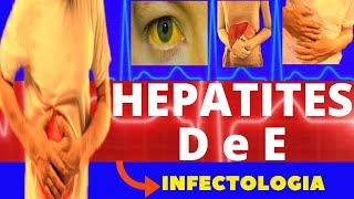 HEPATITE D e E  CARACTERÍSTICAS SINTOMAS DIAGNÓSTICO E TRATAMENTO  INFECTOLOGIA [upl. by Imit]