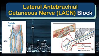 LATERAL ANTEBRACHIAL CUTANEOUS NERVE Block  A quotHowToquot Guide [upl. by Berl]