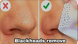 How to make blackheads remove at home  DIY Blackheads Remove Cream [upl. by Attenna]