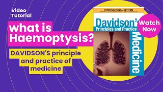 HAEMOPTYSIS  Lectures on Haemoptysis  davidson medicine [upl. by Adnerak386]