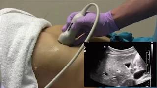 How I do it Ultrasound of the Abdomen [upl. by Raynell]