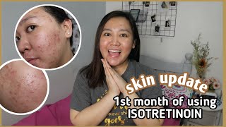 SKIN UPDATE ♡ 1ST MONTH OF MY ISOTRETINOIN JOURNEY [upl. by Eyla]