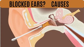 quotBlocked Ears Unveiled 5 Surprising Causes You Never Knew Aboutquot English [upl. by Nakah]