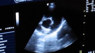 Echocardiogram of PDA in a Dog [upl. by Naawaj]