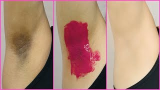 How To Lighten Dark Underarms PERMANENTLY  100 Naturally  Anaysa [upl. by Mloc248]