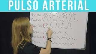 PULSO ARTERIAL ¡Todo lo que tienes que saber  Mentes Médicas [upl. by Sset]