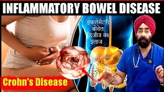 DIET for IBD  Crohns Disease का मेडिकल कारन और इलाज  Explained in HIndi by DrEducation [upl. by Lily404]