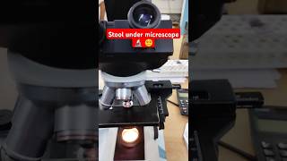 💩 Stool microscopic examination  Stool RE Test  Stool under Microscope [upl. by Rehpotirhc]