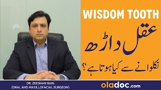 Wisdom Tooth Removal  Aqal Darh Kab Nikalta Hai  Wisdom Tooth Extraction  Aqal Darh Ka Fori Ilaj [upl. by Knudson]