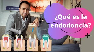 ¿Necesitas un tratamiento de ENDODONCIA  Dr Alvaro Campos [upl. by Leahcimnoj208]