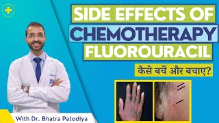 Fluorouracil  Side Effects Of Chemotherapy  Avoid With Easy 7 Steps  Dr Bharat Patodiya [upl. by Nayllij483]