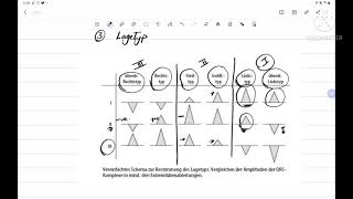 EKG Grundkurs mit EKG Beispiele [upl. by Grose]