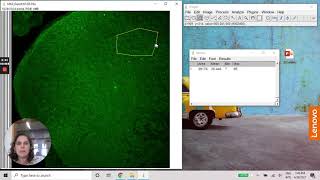 ImageJ  Densitometry using MAX projection image [upl. by Rosse106]