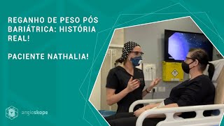 Reganho de peso pós bariátrica história real Paciente Nathalia [upl. by Amitak]