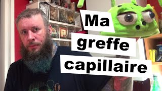 MA GREFFE CAPILLAIRE ep 48 [upl. by Atinniuq]