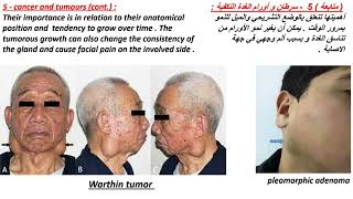 parotid gland 4 الغدة النكفية [upl. by Trabue]