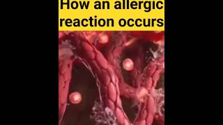 How an allergic reaction occurs biology allergy neet mbbs trending doctor viralvideo shorts [upl. by Atsylak]