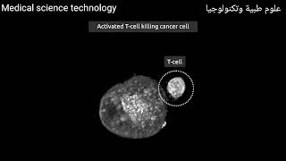 الخلايا التائية في مواجهة السرطان تحت المجهر Tcellsvscancerunderthemicroscope [upl. by Eiramaneet]