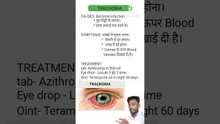 Trachoma treatment [upl. by Lebbie632]