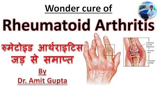 Rheumatoid arthritis cured case Permanent cure of Rheumatoid arthritis [upl. by Eelyac20]