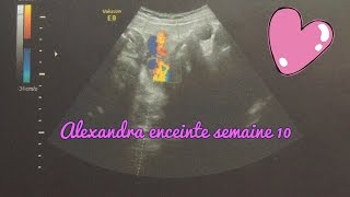 Alexandra enceinte  semaine 10 [upl. by Ahusoj]