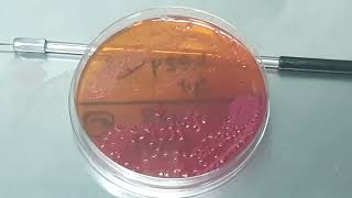 Stenotrophomonas maltophilia Gram staining Culture Characteristics and Wet mount Microscopy [upl. by Nodla]