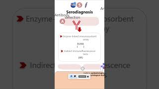 SerodiagnosisGiardia lamblia parasitology microbiology pathology diagnosis neetpg neet [upl. by Hadley]