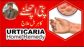 pitti uchalne  chapaki  urticaria ka ilaj  پتی اچھلنا یا چھپاکی کا دیسی علاج [upl. by Jacki]