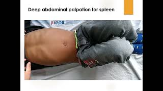 Spleen Palpation Methods I Deep Abdominal Palpation for Spleen  Pediatrics [upl. by Canotas]