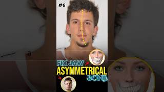 Fix Jaw Symmetry  Mewing Exercise [upl. by Knutson]