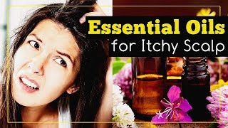 Essential Oils for Itchy Scalp Relief [upl. by Yaresed]