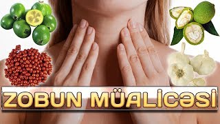 ZOBUN EV ŞƏRAİTİNDƏ MÜALİCƏSİ [upl. by Mittel]