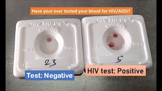 Know your HIV status within half an hour HIV test positive HIV TRI DOT [upl. by Ssac]